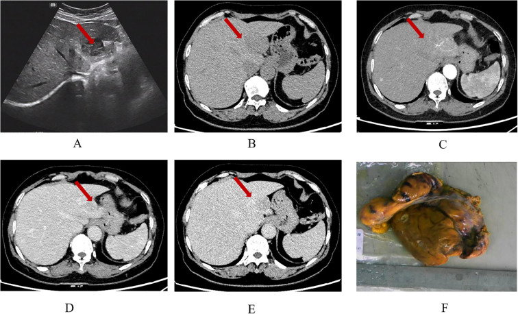 Figure 1