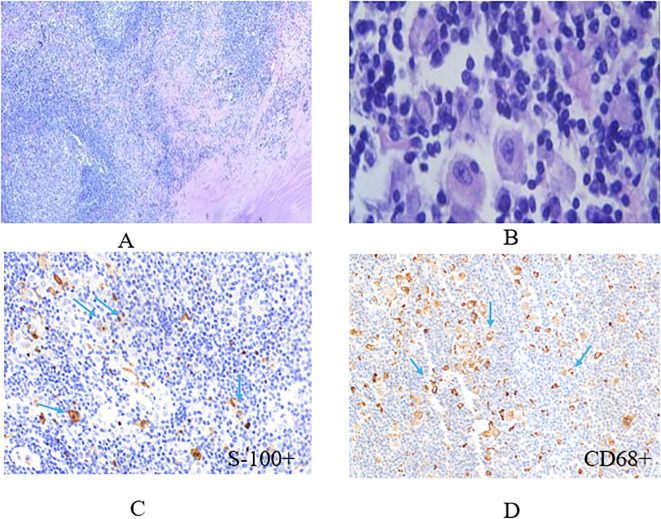 Figure 2