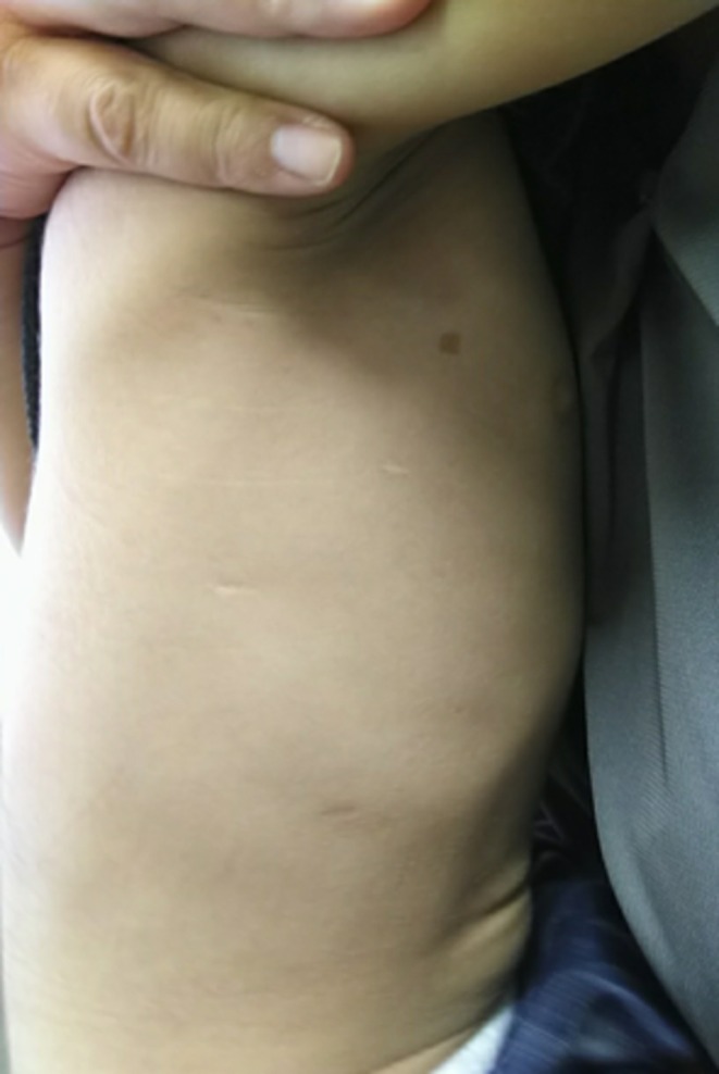 FIGURE 3