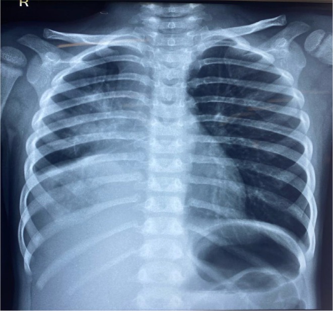 FIGURE 3