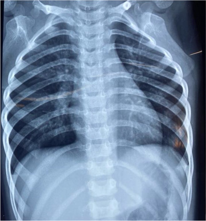 FIGURE 2
