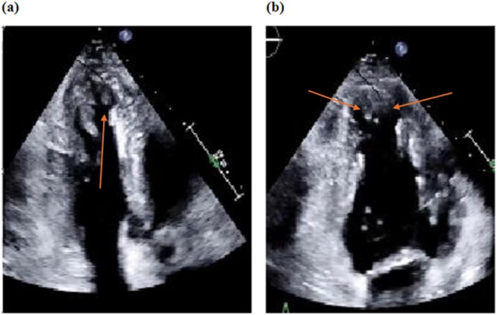 FIGURE 2
