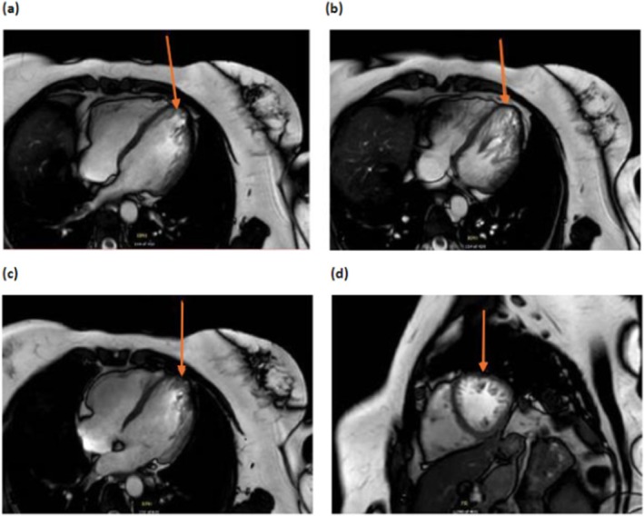 FIGURE 1