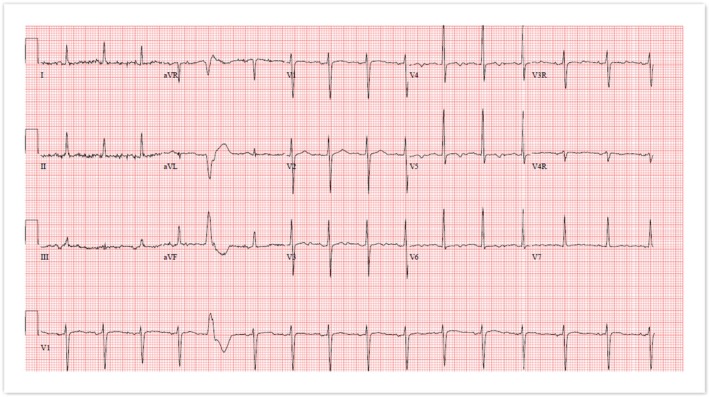 FIGURE 3