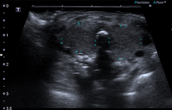 FIGURE 3
