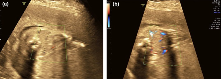 FIGURE 1