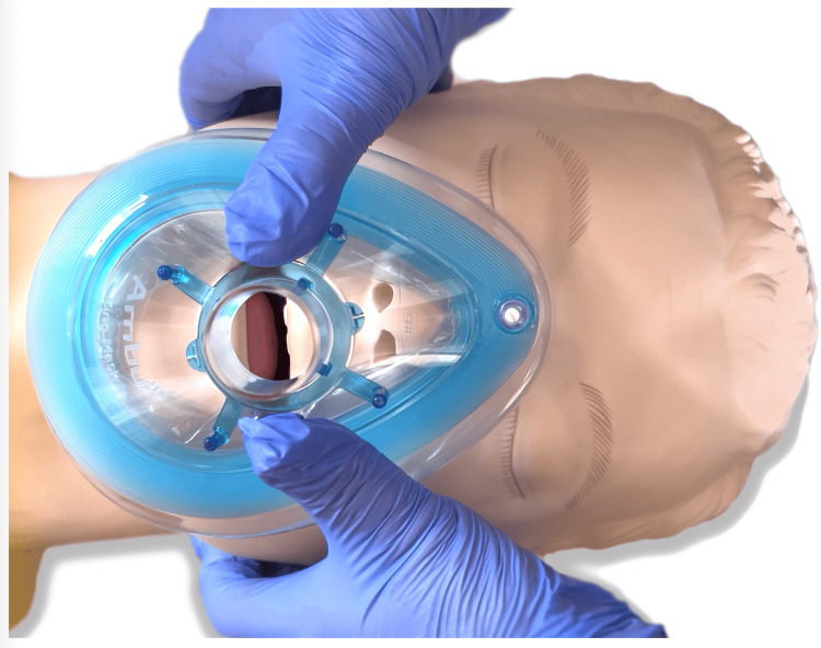 Figure 2
