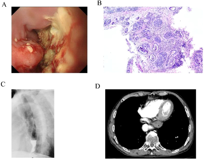 Figure 1
