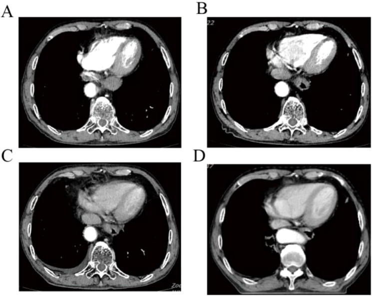 Figure 2