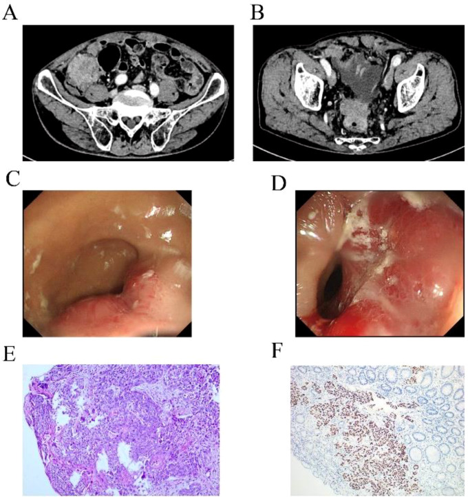 Figure 3