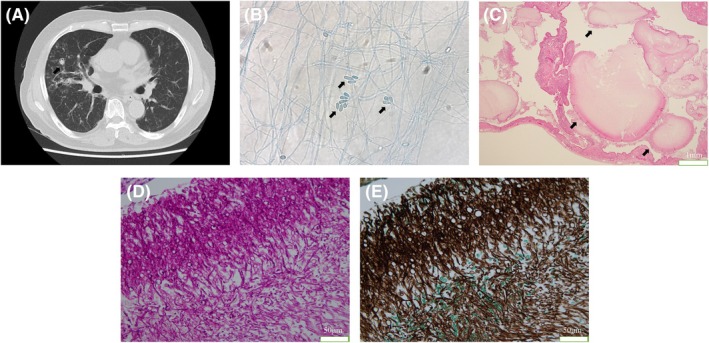FIGURE 1