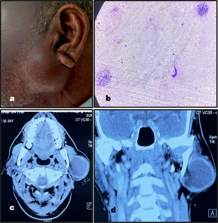 FIGURE 1