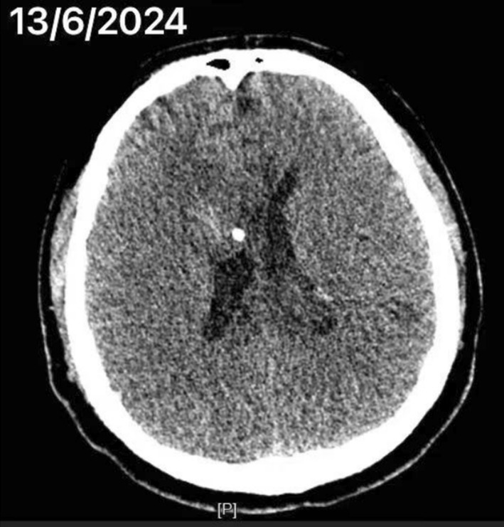 FIGURE 2