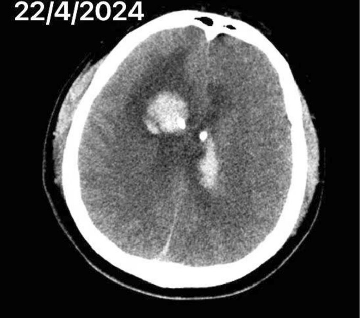 FIGURE 1