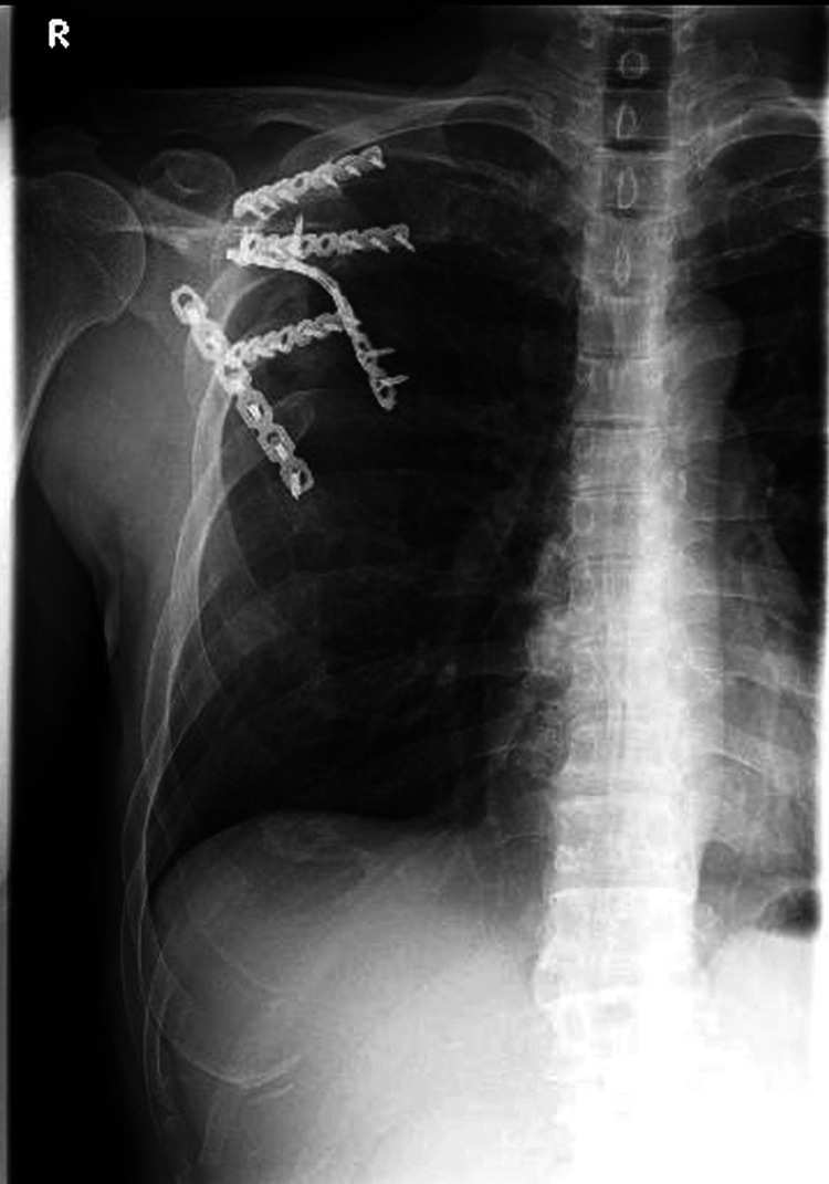 Figure 9