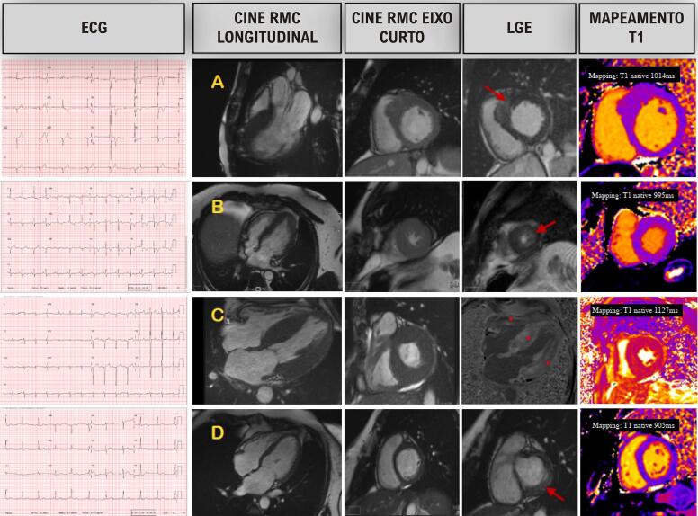 Figure 16