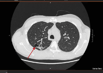 Figure 9