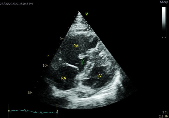 Figure 4