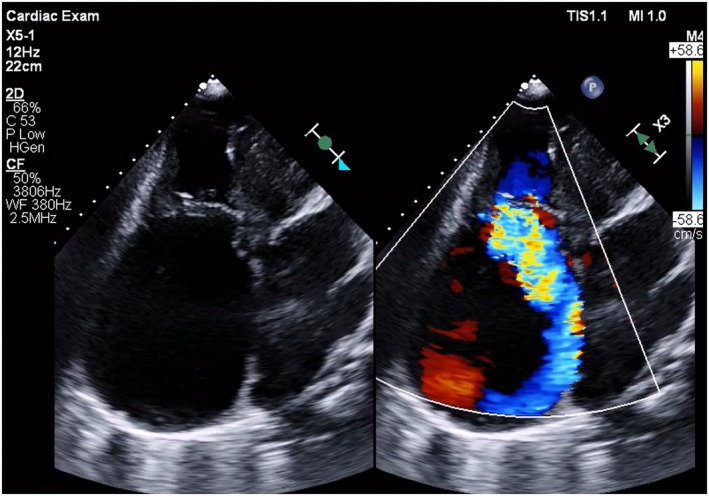 FIGURE 1