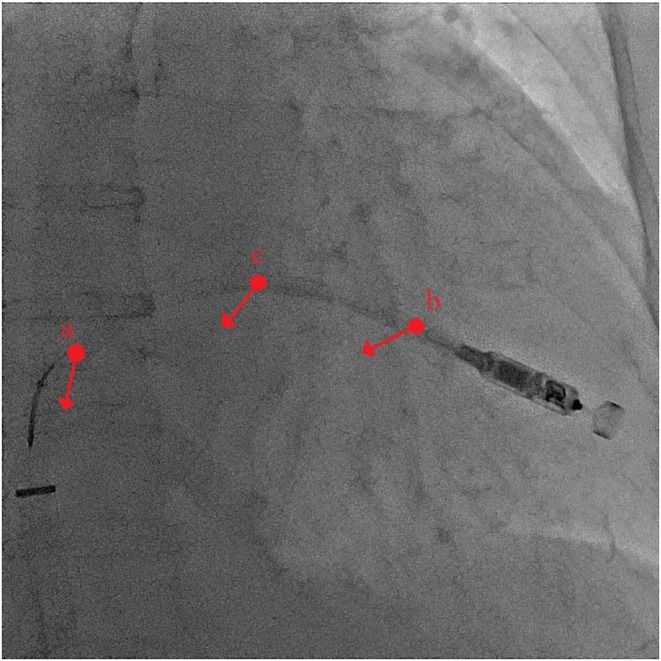FIGURE 4