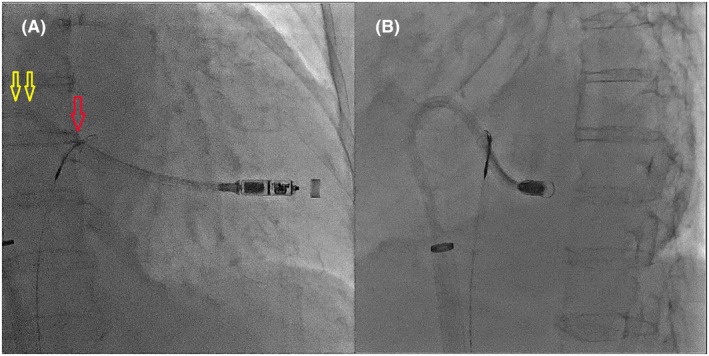 FIGURE 3