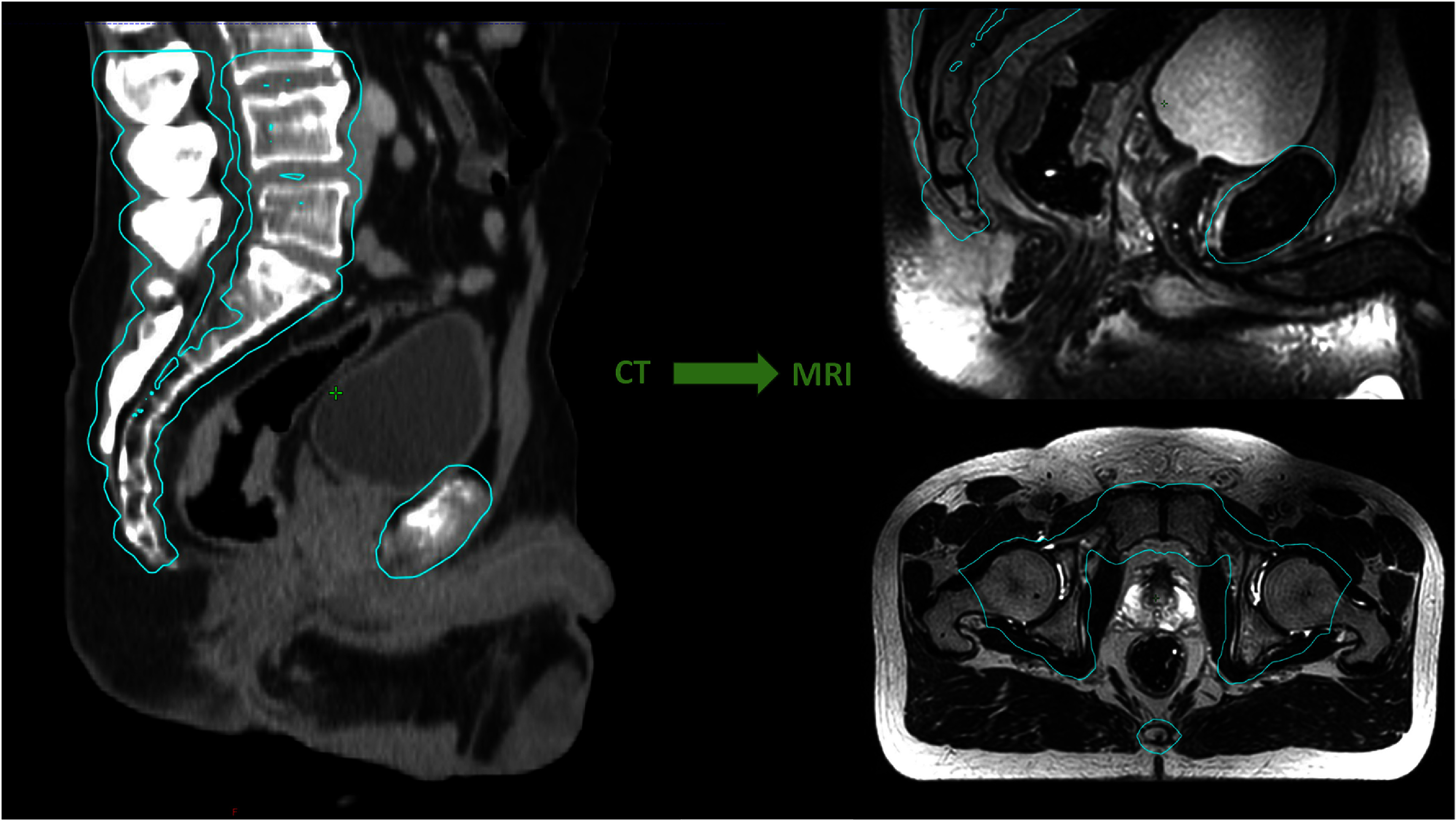 Figure 22