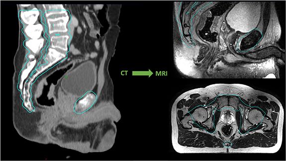 Figure 24