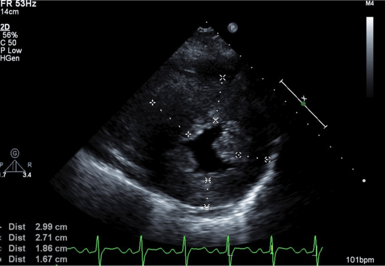 Figure 5