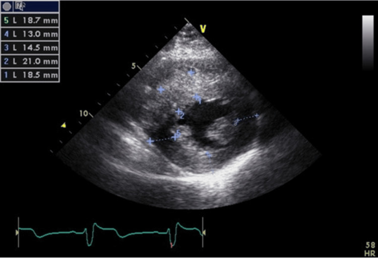 Figure 9