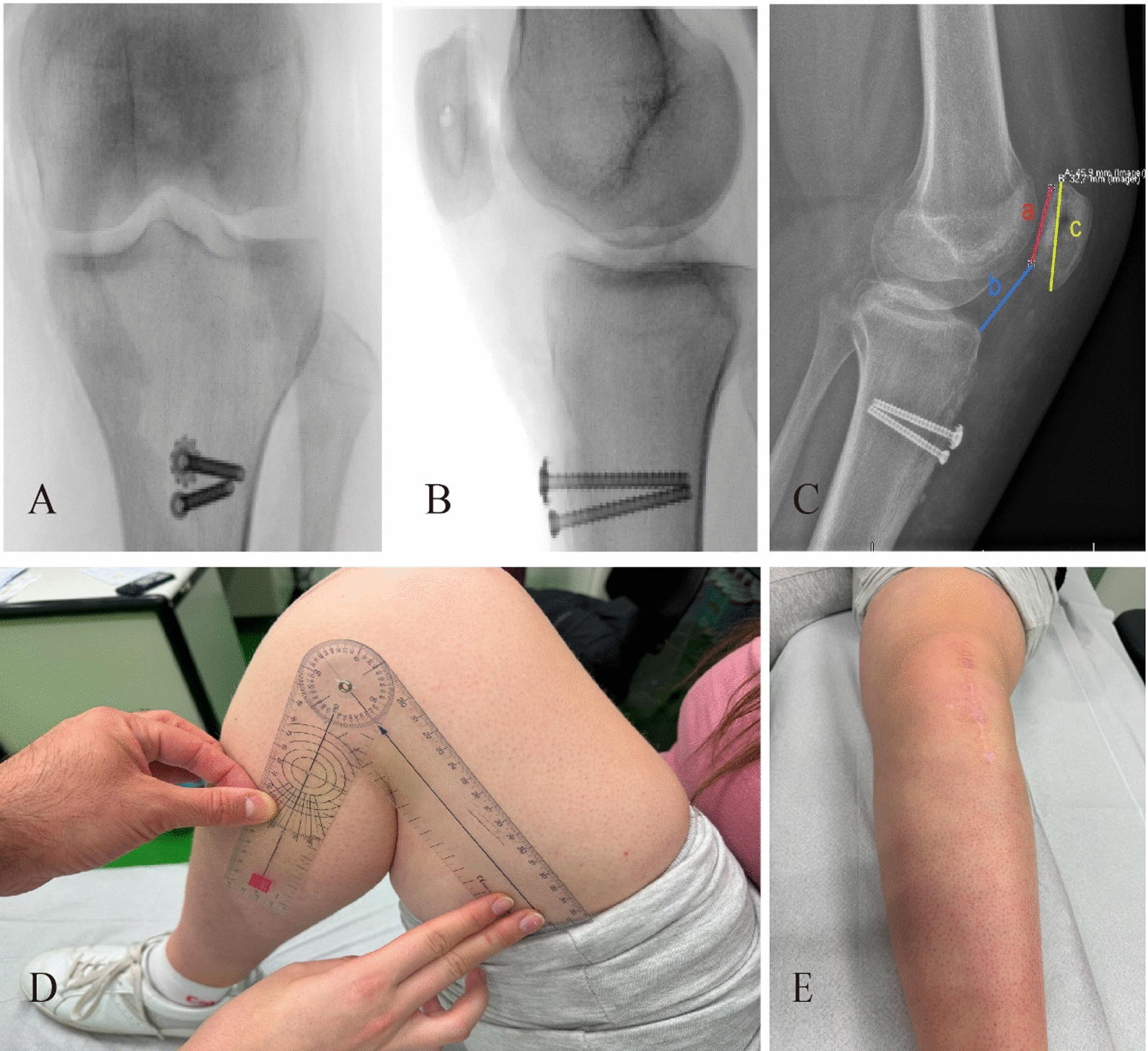 Figure 6