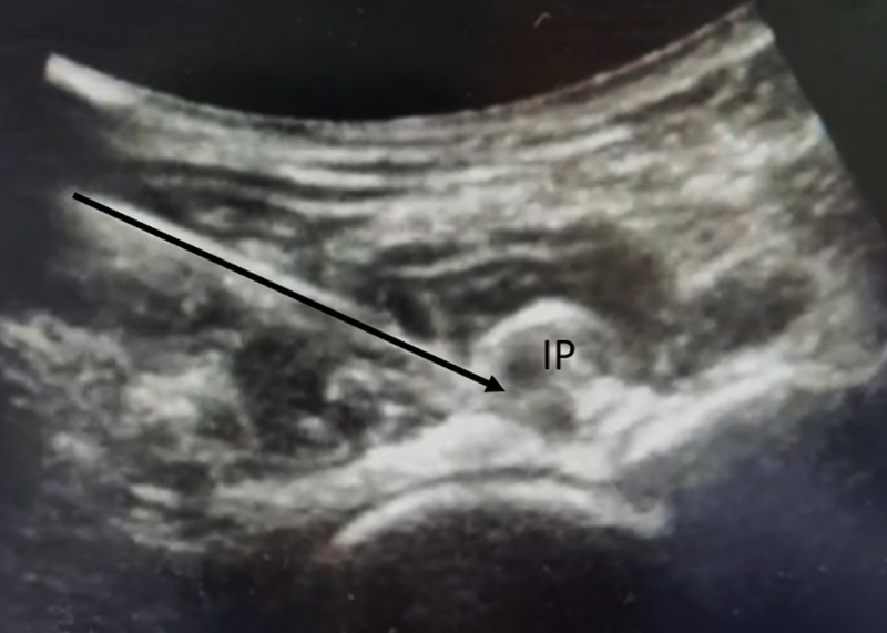 Figure 16