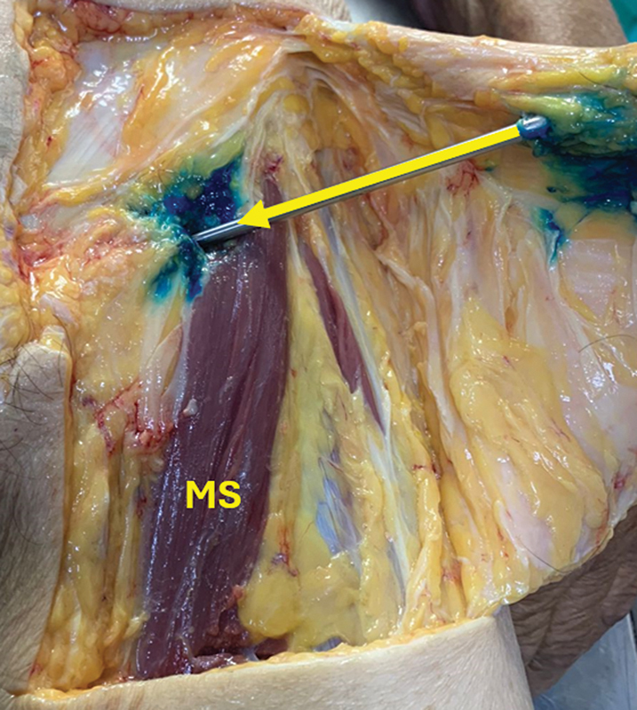Figure 17