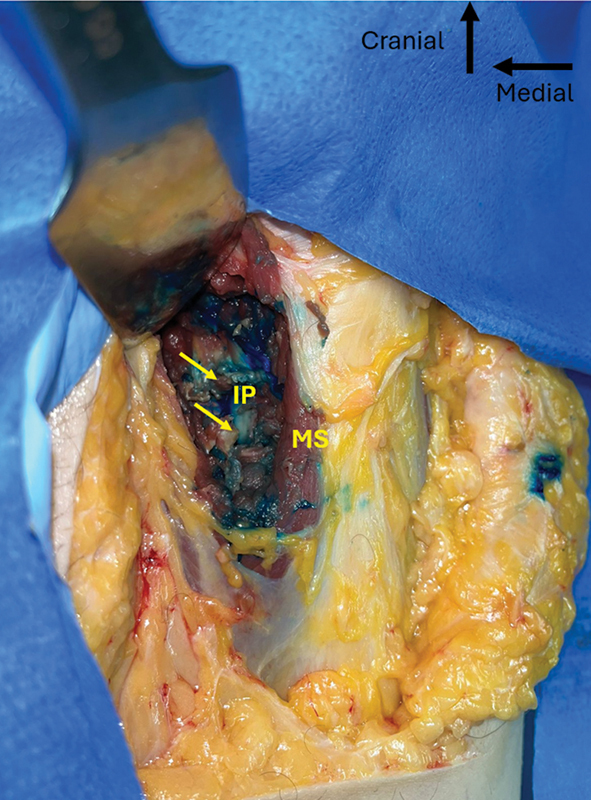 Figure 18