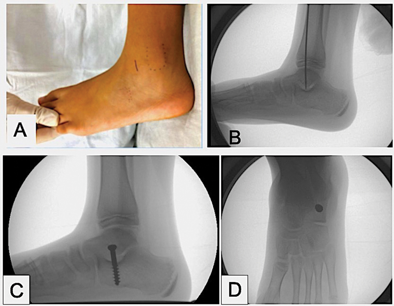 Figure 13