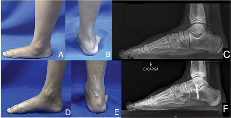 Figure 15