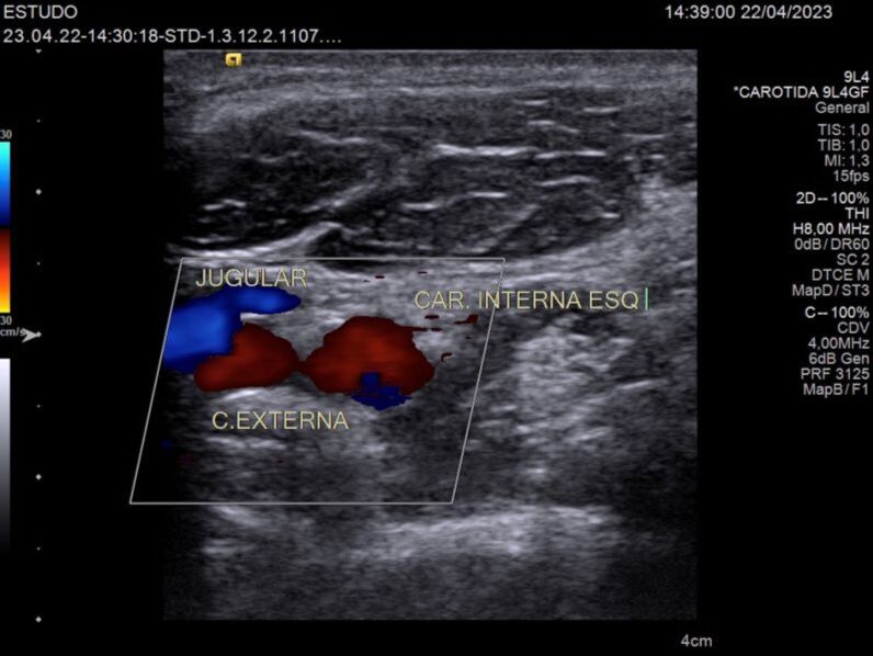 Figure 6