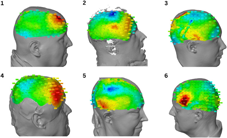 FIGURE 1
