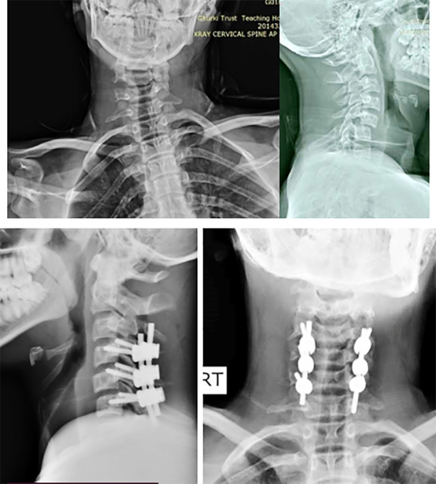 Fig.3