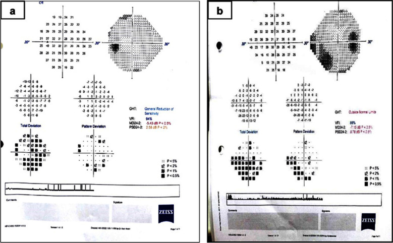 Fig.1