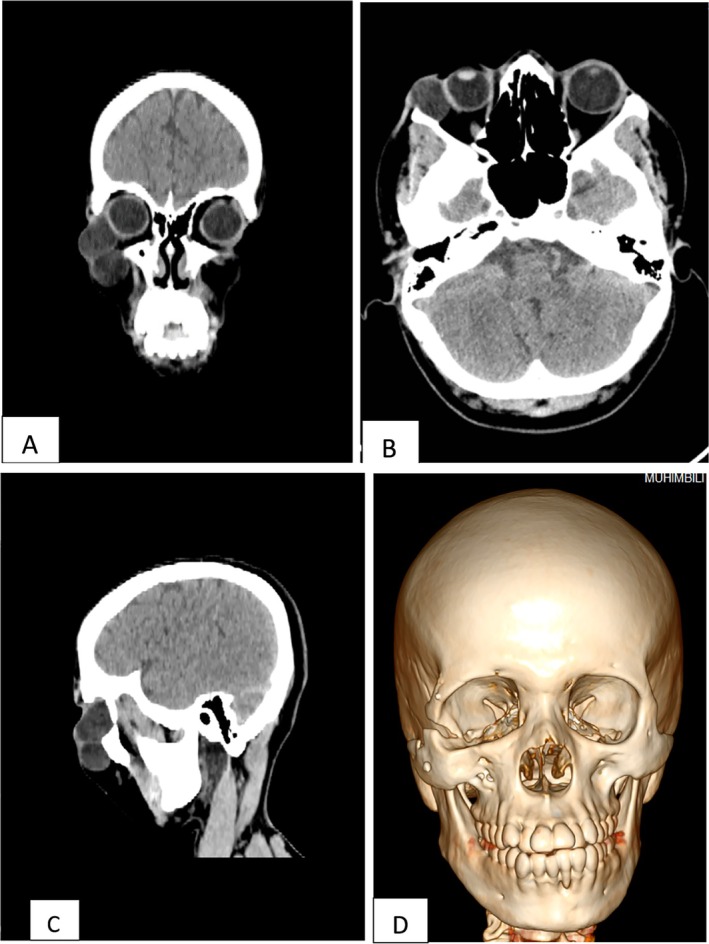 FIGURE 3