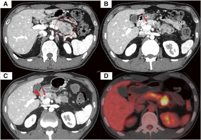 Fig. 1
