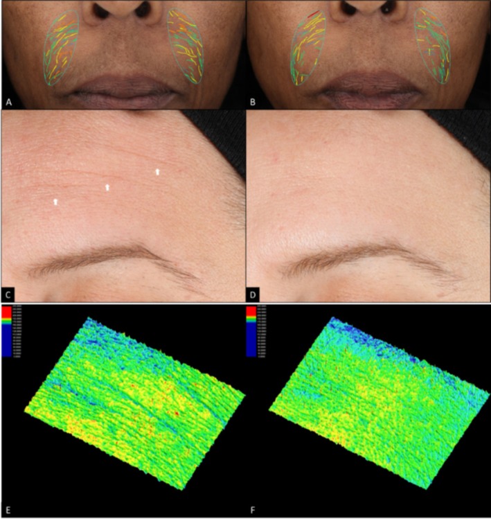 FIGURE 4