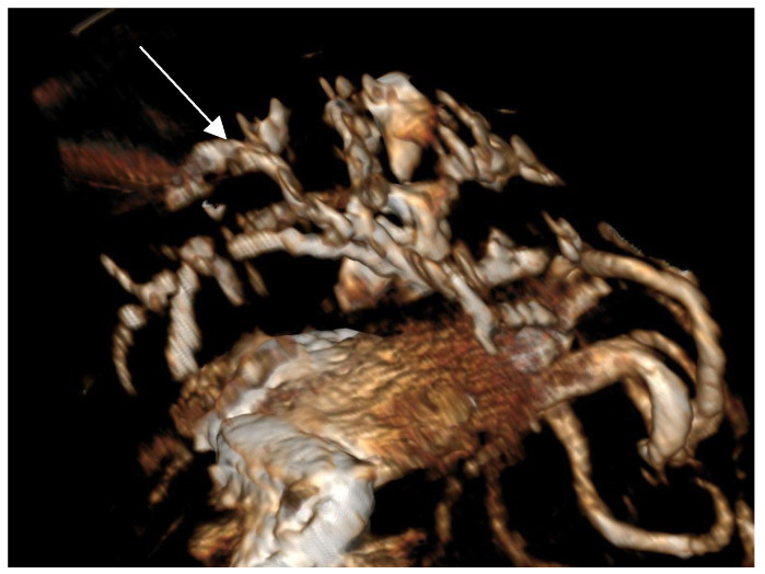 Figure 6