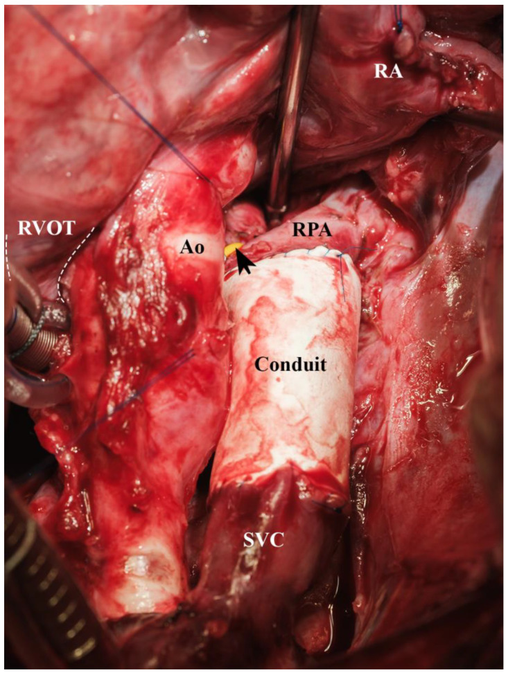 Figure 12