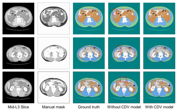 Figure 11