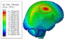 Figure 32