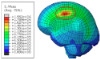 Figure 38