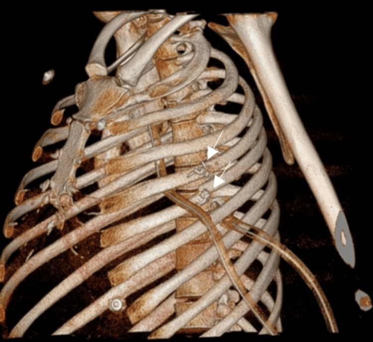 Figure 9