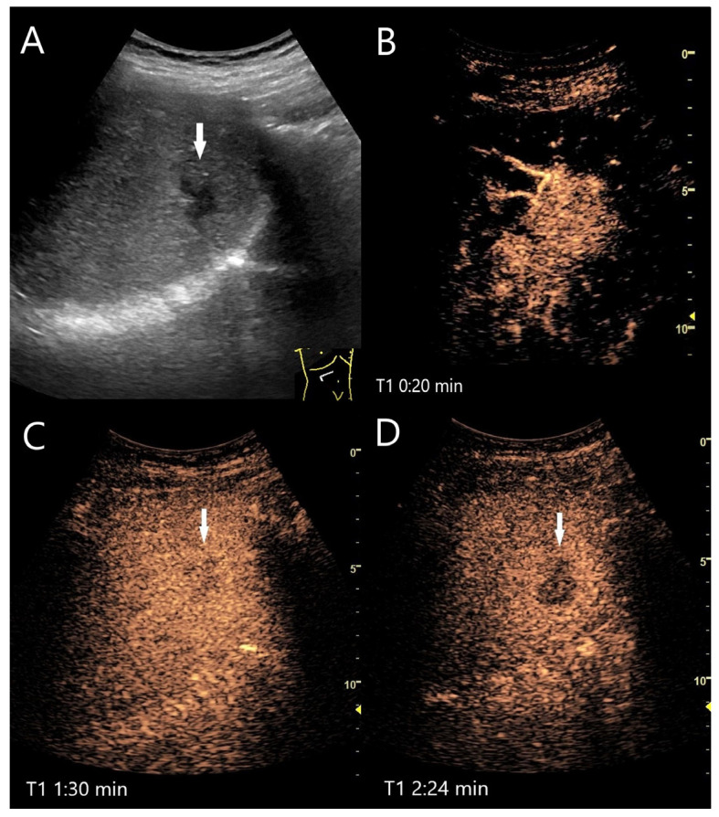 Figure 11