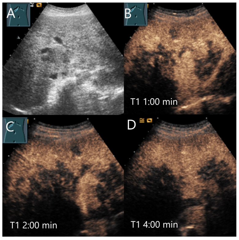 Figure 15